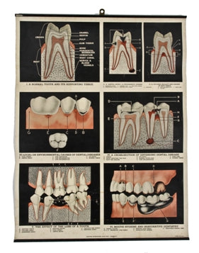 original c. 1930's wall-mount dental office tooth anatomy color lithographic print