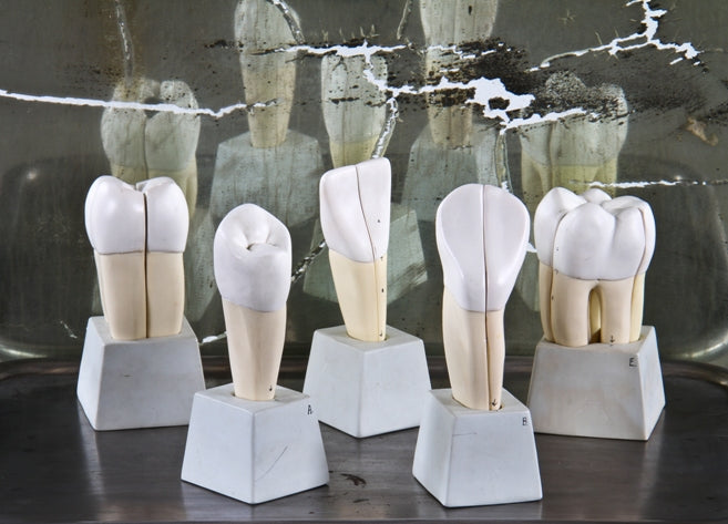 vintage american medical classroom instructional dental morphology 5-part set individually mounted on removable stands