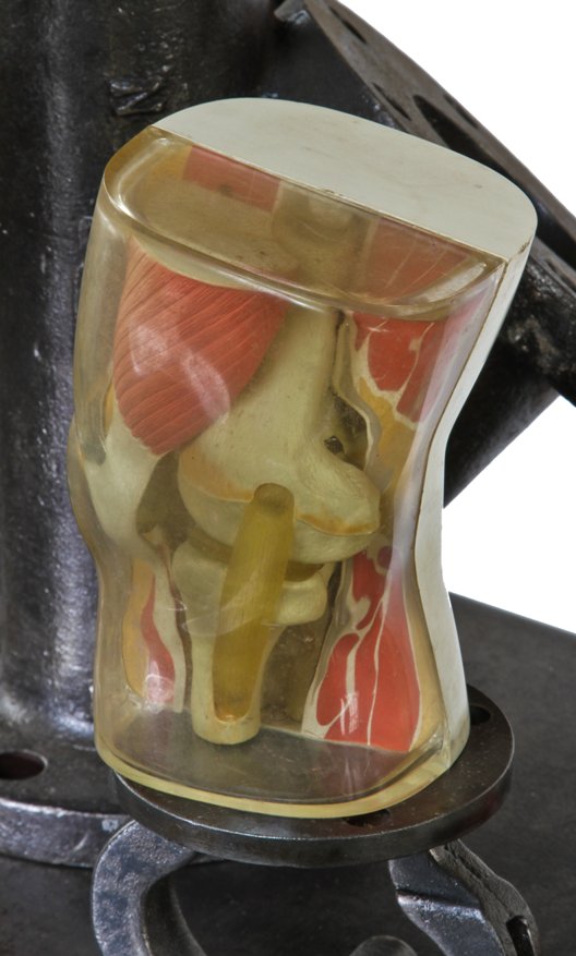 c. early 1960's american  vintage medical human muscled knee joint patient education anatomical model with outer shell molded in clear plastic
