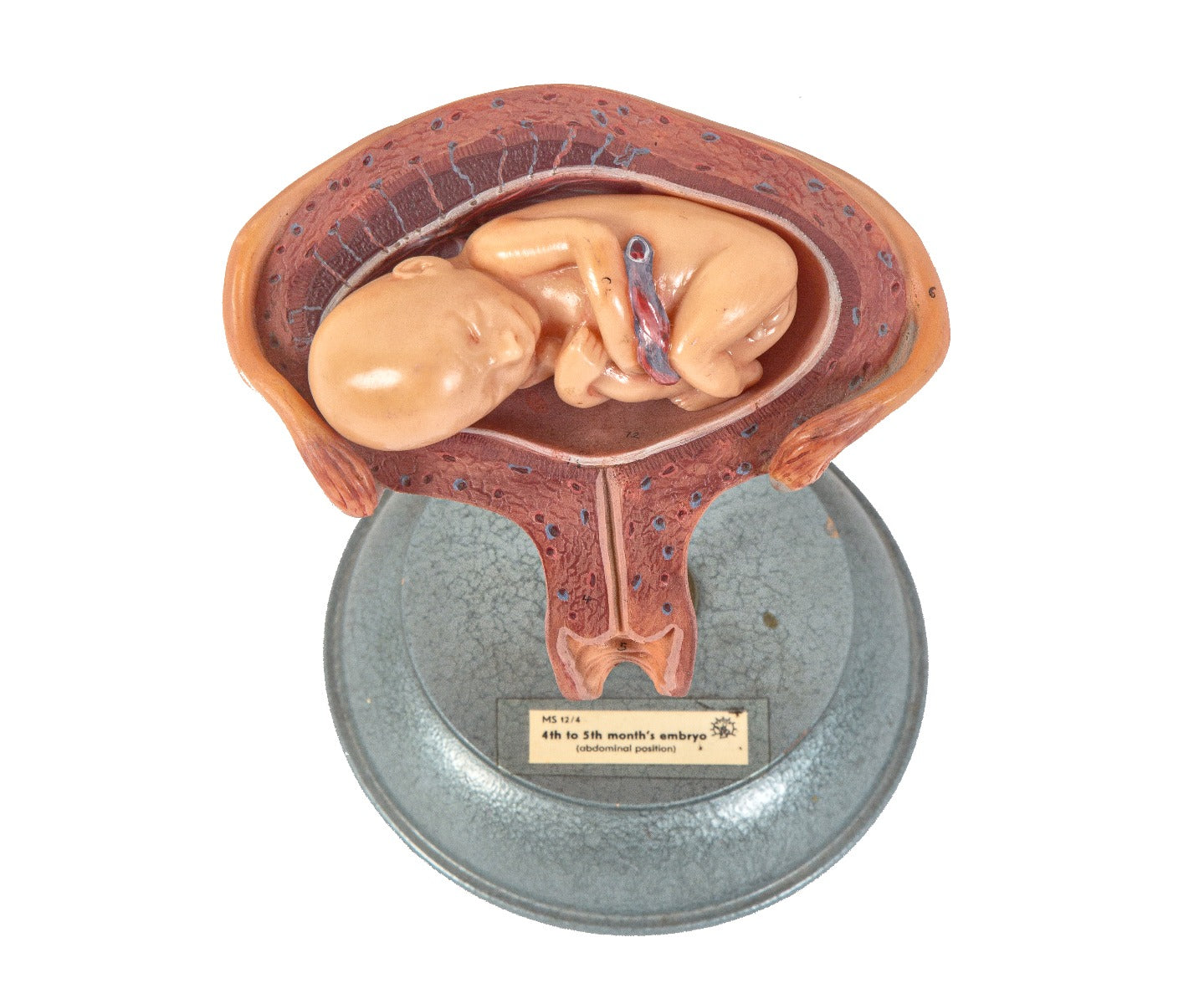 1960's german-made original salvaged chicago public school "pregnancy series" 4-5 month embryo model with stand